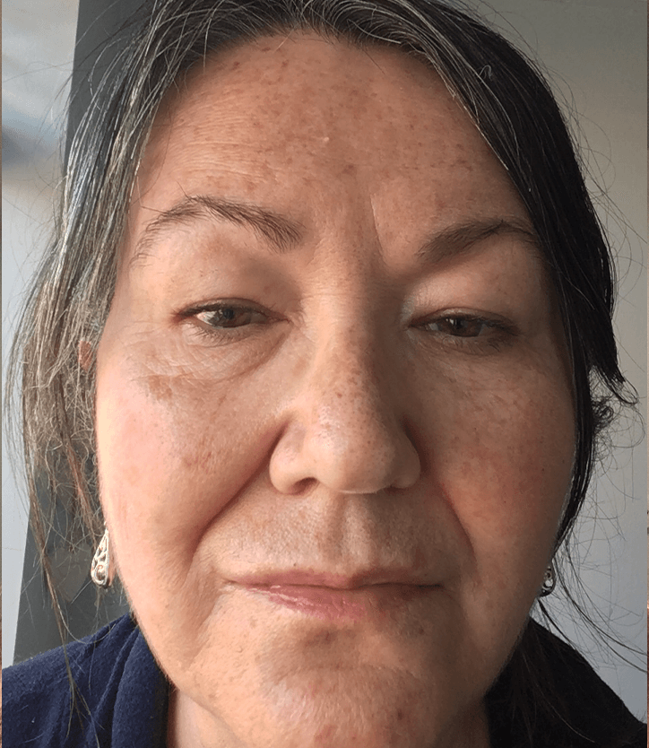 Melanie’s journey