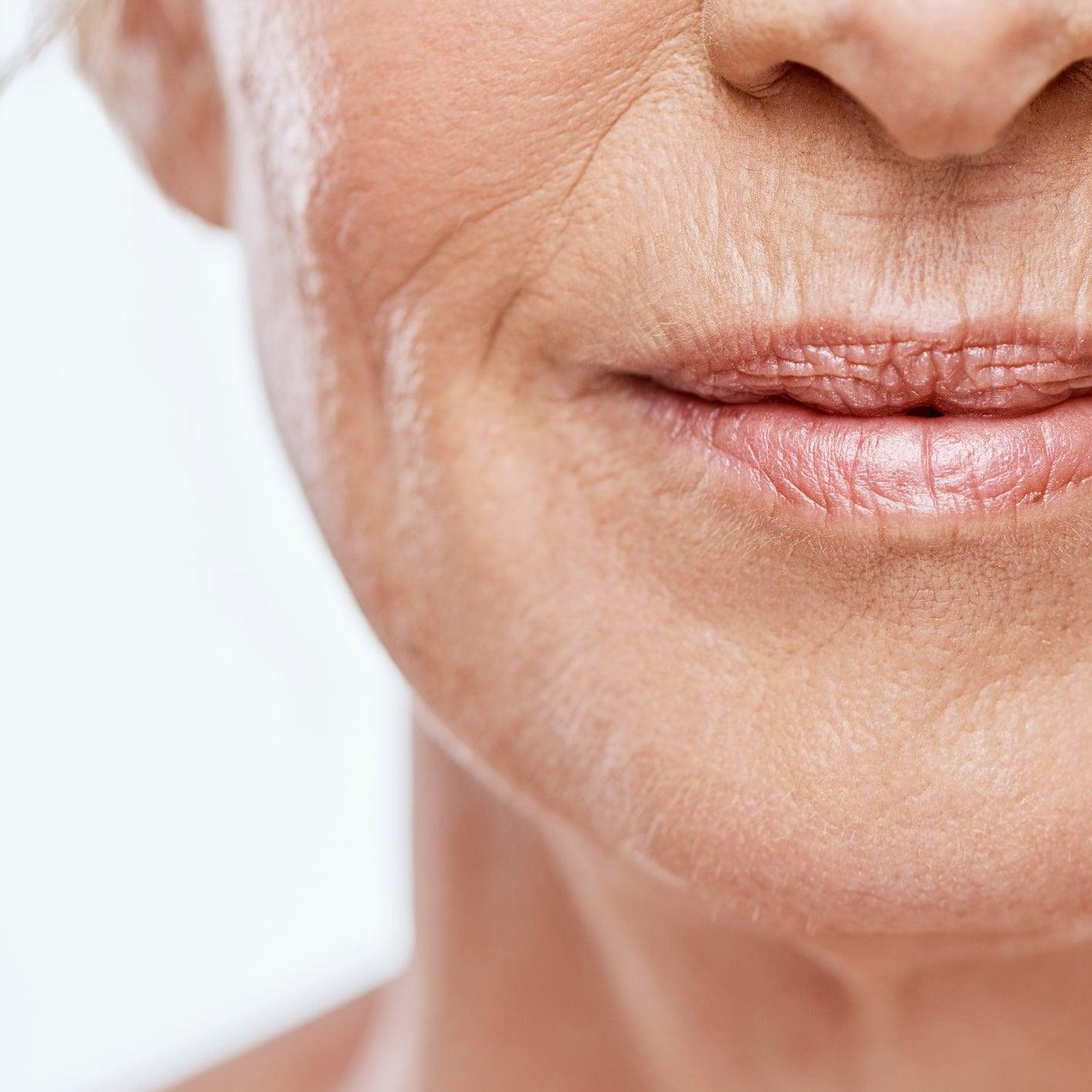 Aging