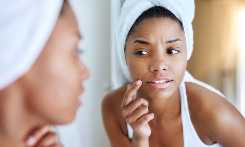 How To Reduce Retinoid Irritation