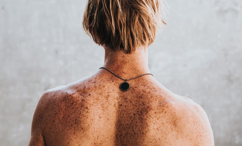 UVA and UVB — What’s The Difference?